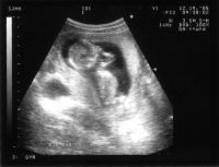 ultrasound-2005-12-19.jpg